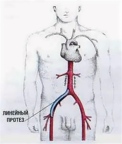 Форум после акш