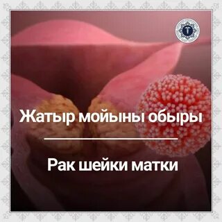 Сексуалдық бейне войеризм