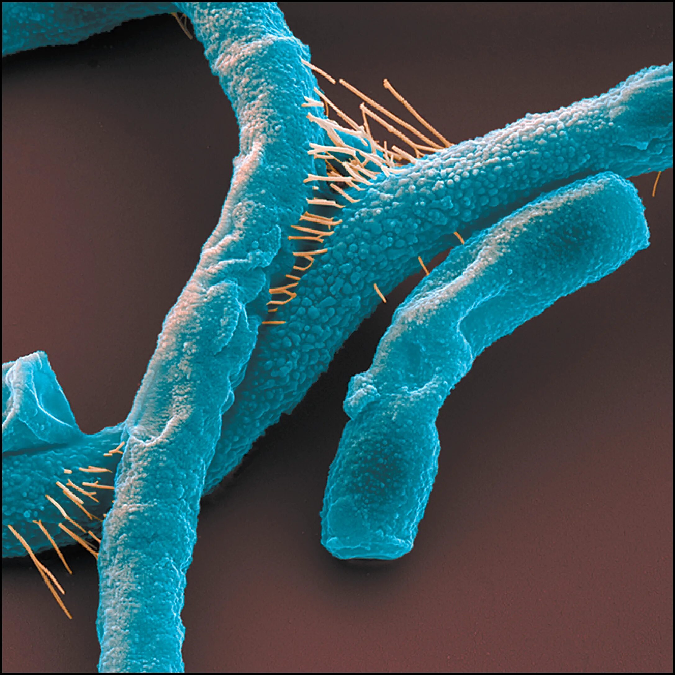 Бацилла антрацис. Bacillus anthracis Сибирская язва. Bacillus anthracis патогенность. Клетка язвы