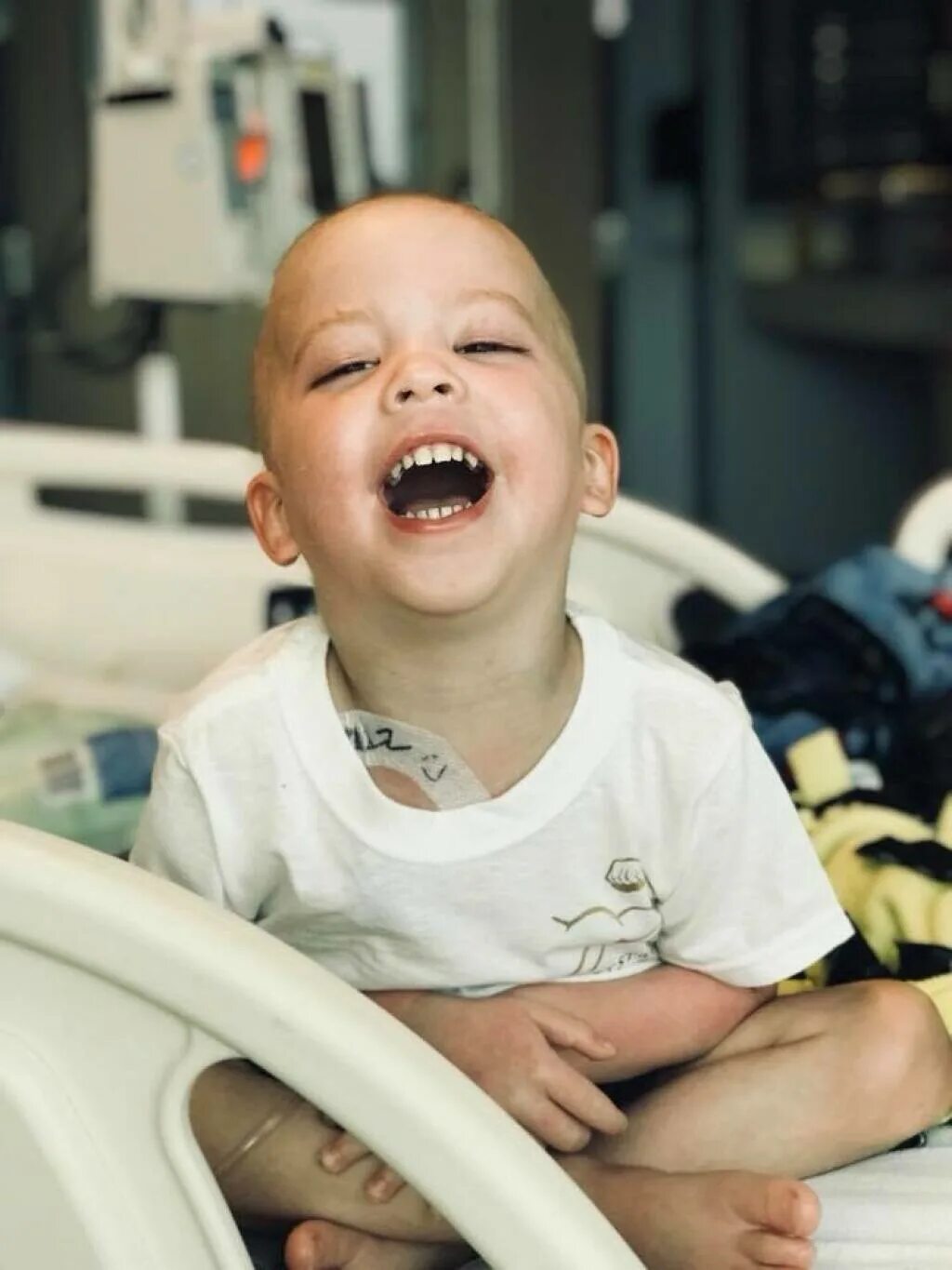 Фото мальчика больного ртом. Маленький мальчик с онкологией. Припухлость у мальчика
