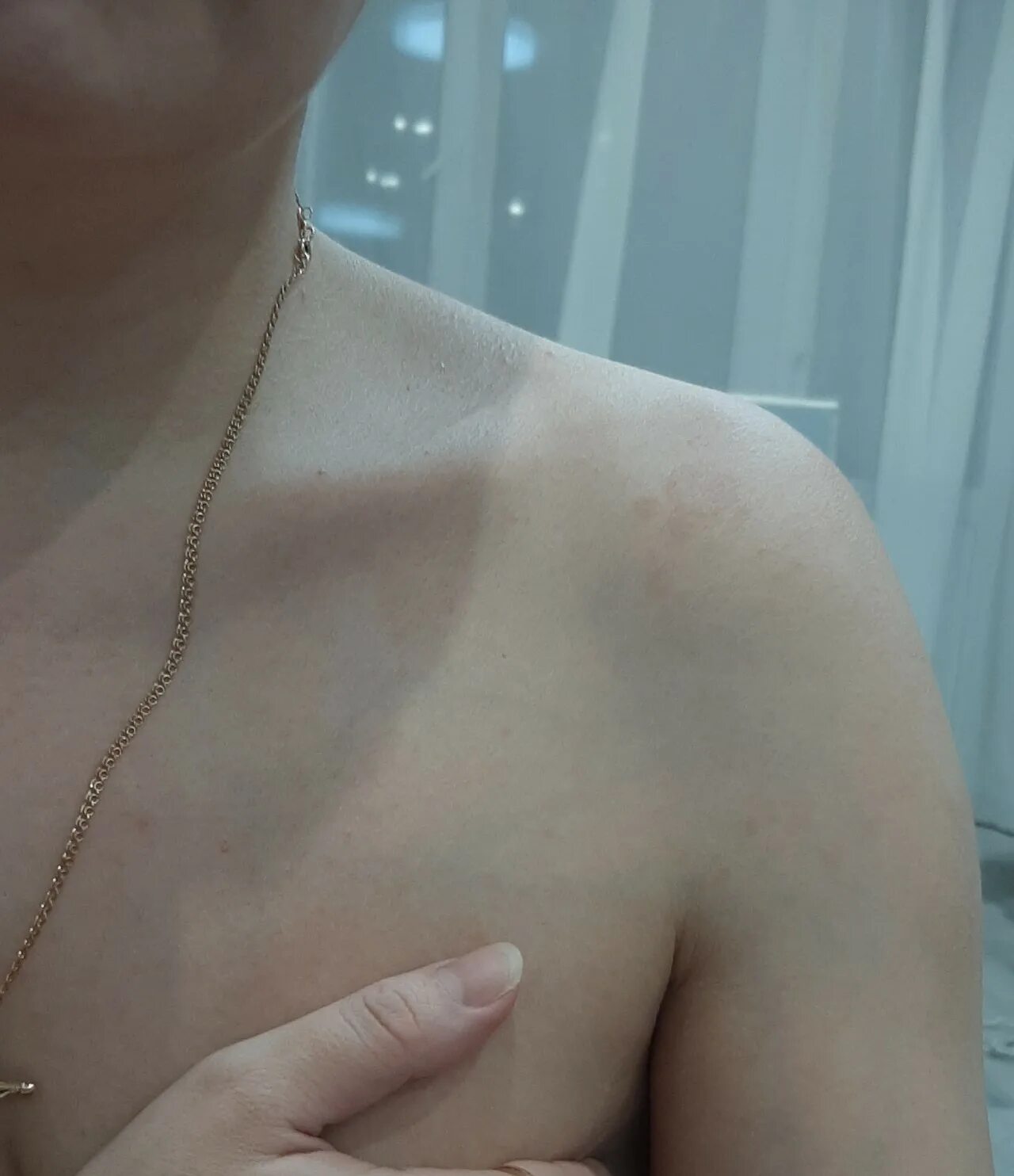 Красное пятно на груди фото Неровное коричневое пятно на коже Вопрос дерматологу 03 Онлайн