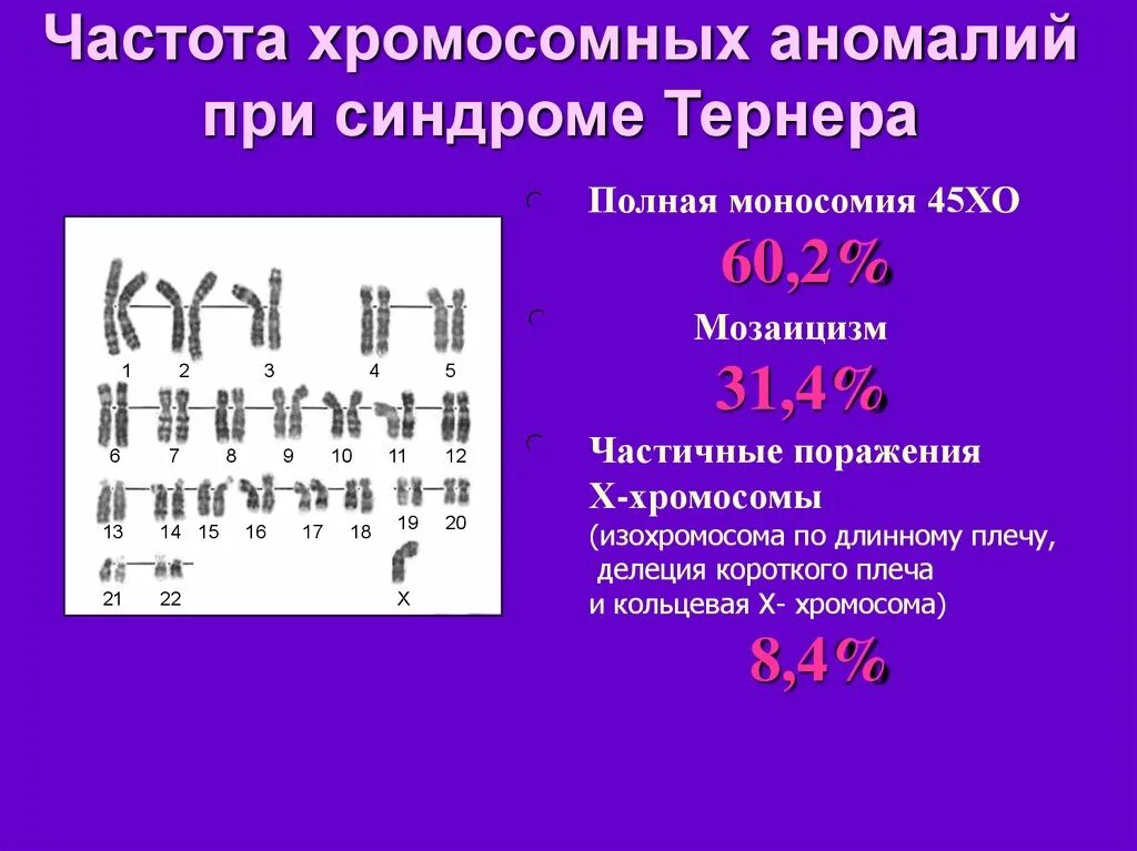 Кольцевая хромосома 1. Кольцевая хромосома. Хромосомная делеция короткого плеча. Моносомия по у хромосоме. Делеция плеча хромосомы.
