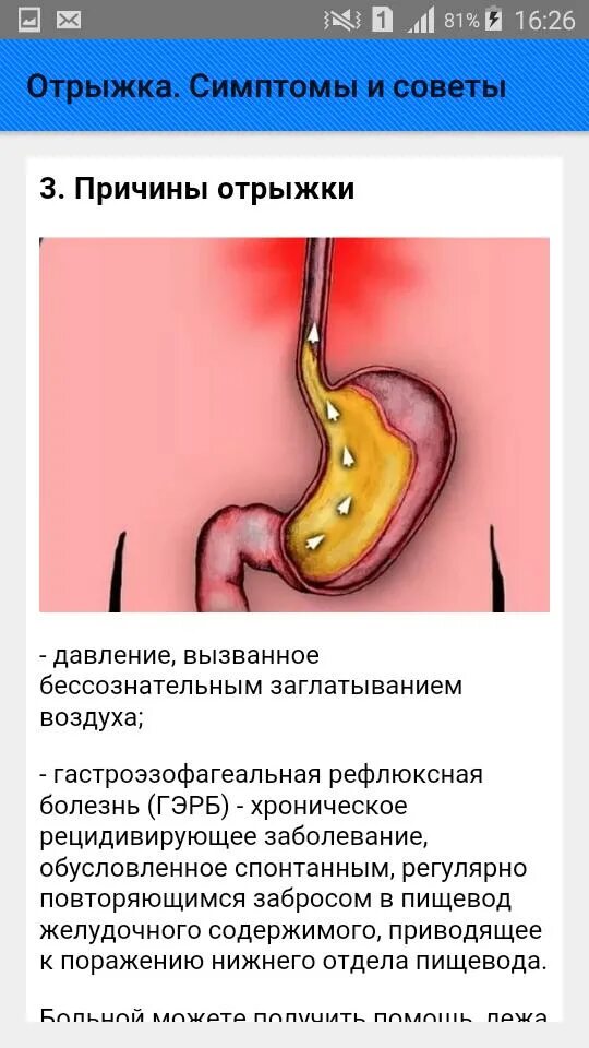 Почему отрыжка рыбой. Отрыжка. отрыжка воздухом после еды.