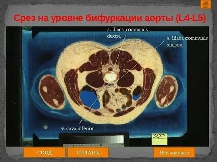 Уровень среза