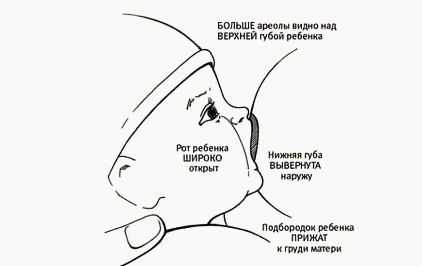 Заглатывание воздуха латынь. Неправильное положение ребенка при кормлении. Схема правильного прикладывания ребенка к груди. Грудное вскармливание правильное прикладывание схема. Как прикладывать ребенка к груди.