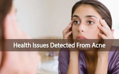 Issues detected