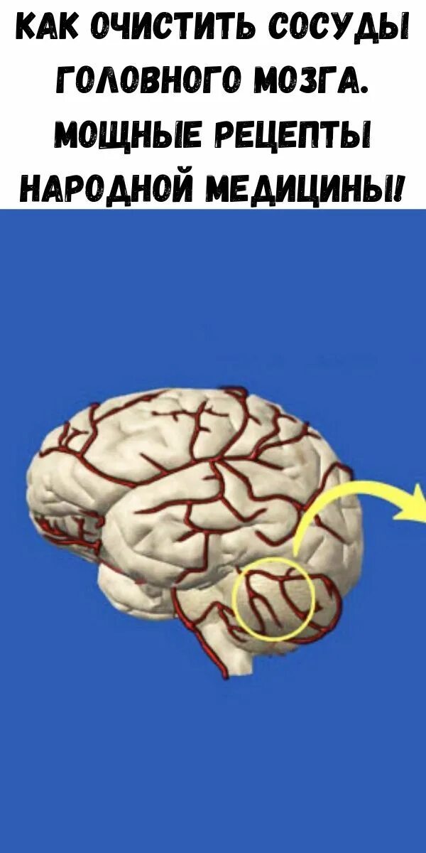 Очистка сосудов головы. Сильный мозг. Очистить сосуды головного мозга. Как чистить сосуды головного мозга.