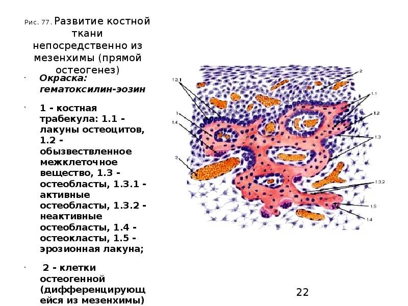 Прямой и непрямой остеогенез гистология. Развитие кости на месте соединительной ткани. развитие костной ткани непосредственно из мезенхимы. развитие кости из мезенхимы прямой остеогенез препарат гистология. развитие кости из мезенхимы прямой остеогенез.