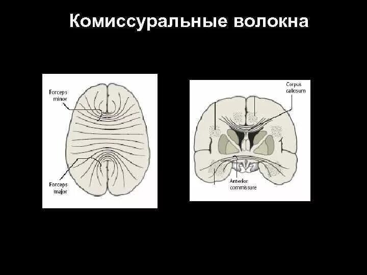 Волокна белого вещества. Комиссуральные волокна головного мозга. ассоциативные комиссуральные и проекционные волокна. комиссуральные ассоциативные и проекционные волокна головного мозга. комиссуральные (спаечные) нервные волокна.