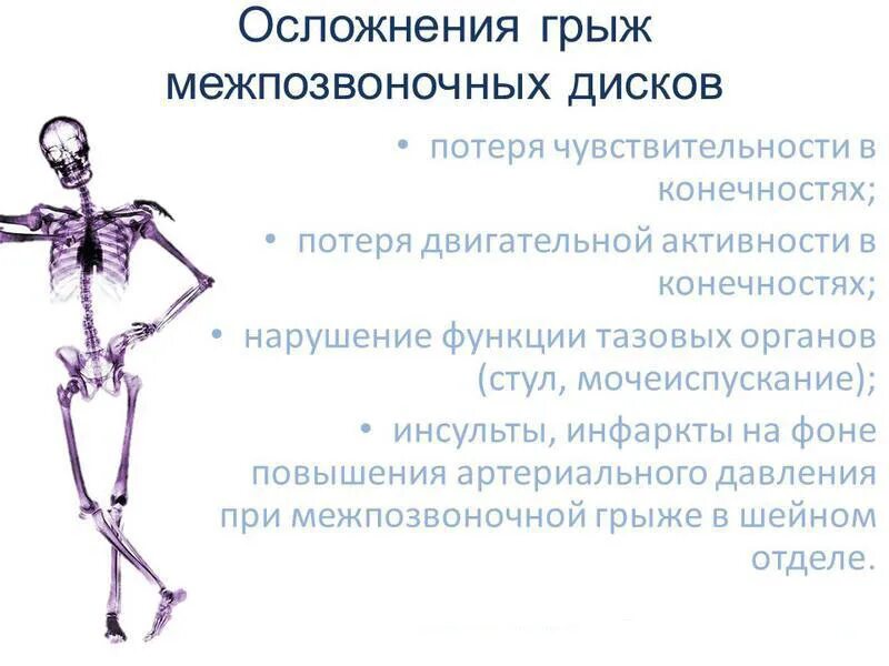 Осложнения межпозвонковой грыжи. Осложнения межпозвонковой грыжи. Межпозвоночная грыжа. Спинная грыжа. Остеохондроз осложнился грыжей.