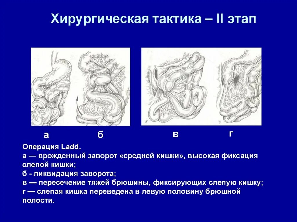 Операция непроходимость