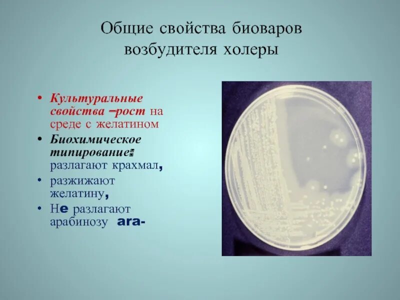 Холера питательные среды. Холера культуральные свойства. Культуральные свойства холерного вибриона. Возбудитель холеры культуральные свойства. Среды для холеры.