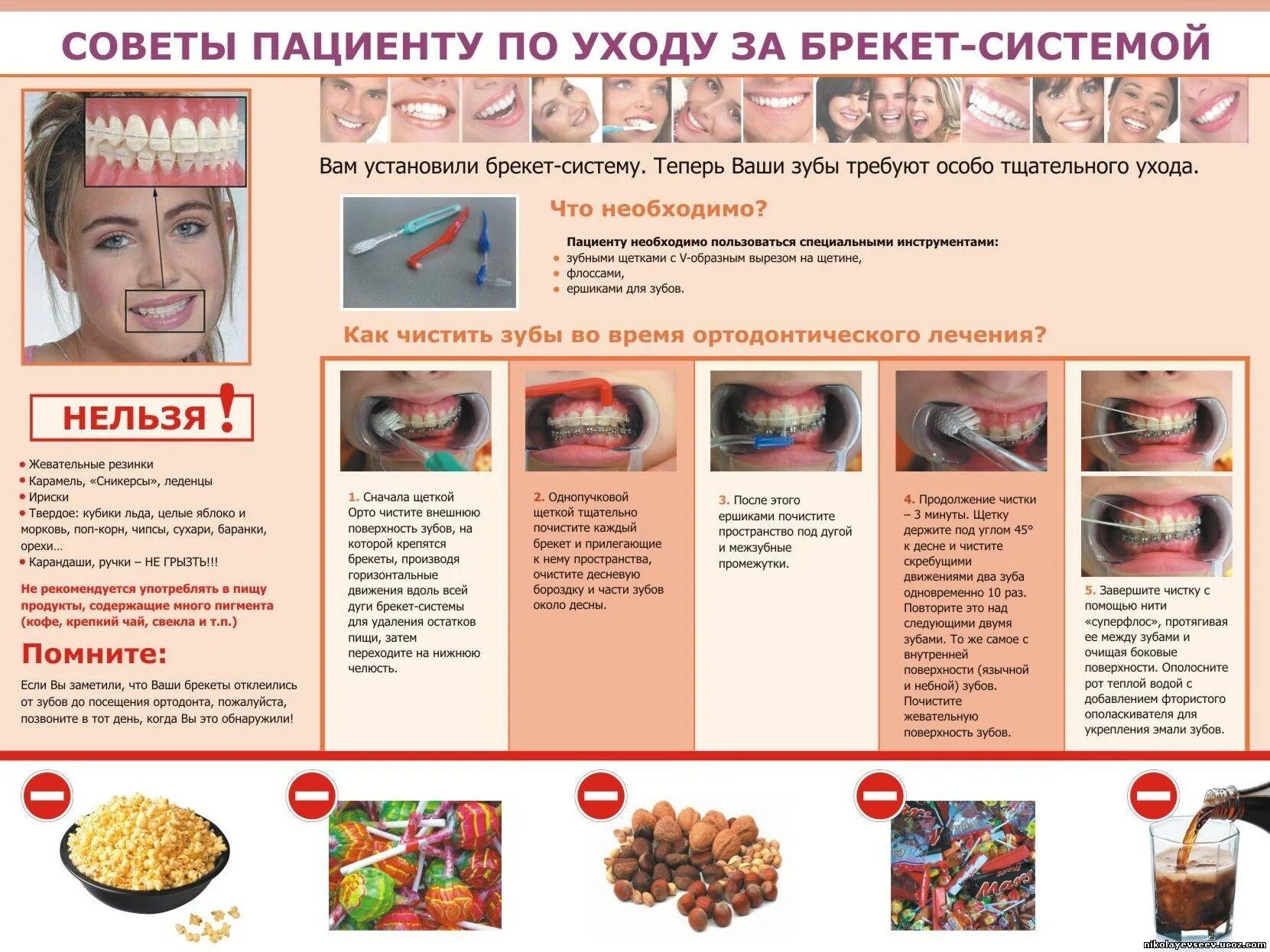 Рекомендации пациентам со съемными протезами. Рекомендации после установки. Рекомендации до и после имплантации зубов. Гомеопатическое назначение после имплантации. Рекомендации после установки.