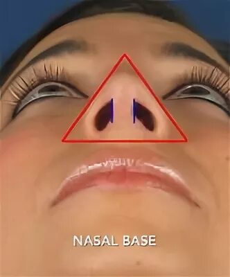 Треугольный нос.