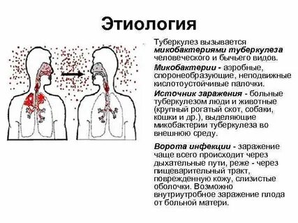 Анатомия туберкулеза