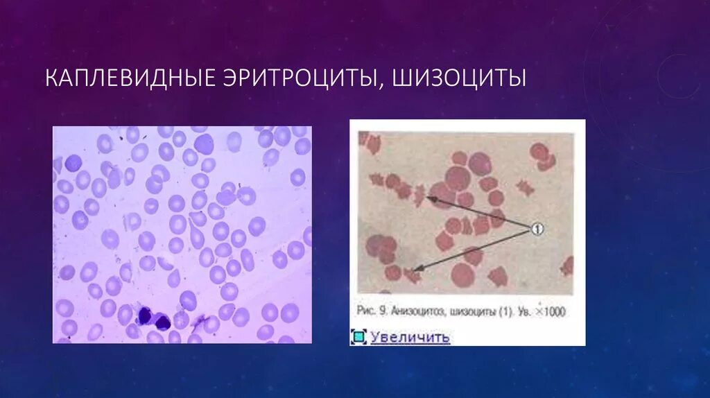 Эритроциты в мазке что это значит. Шизоциты. эритроциты.
