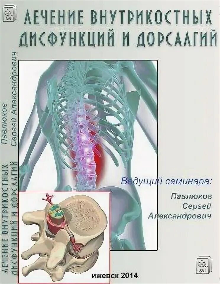 Дорсалгия симптомы. Дорсалгия грудного отдела позвоночника. Дорсалгия учебное пособие. Клиника дорсалгии. Внутрикостные дисфункции.