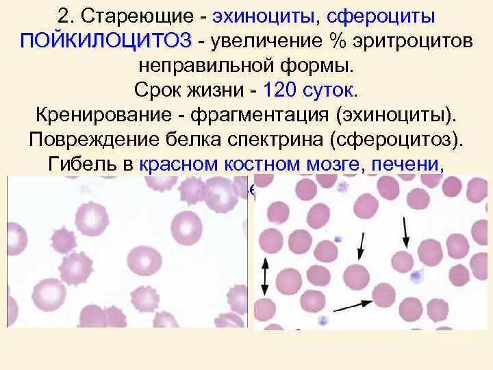 Формы эритроцитов эхиноциты. Эритроциты форма сфероцит. Стареющие формы эритроцитов. Стареющие и патологические формы эритроцитов. Эхиноциты