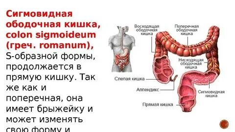 Где расположена сигмовидная
