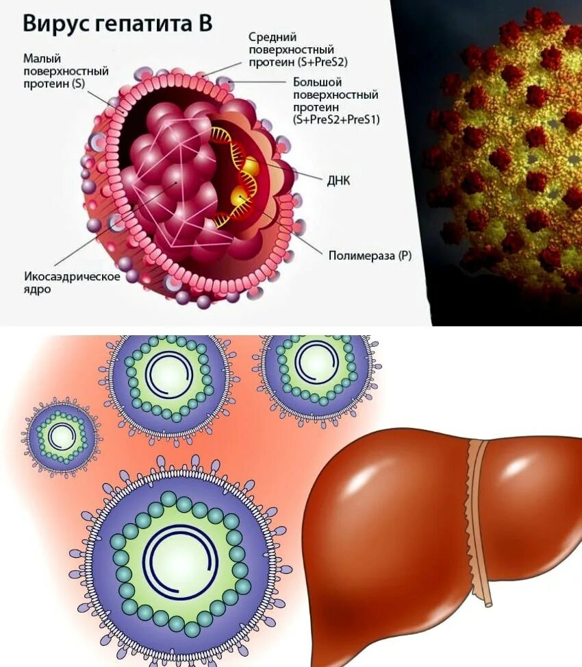 Вирусные гепатиты. Вирусный гепатит б. Вирусный гепатит м
