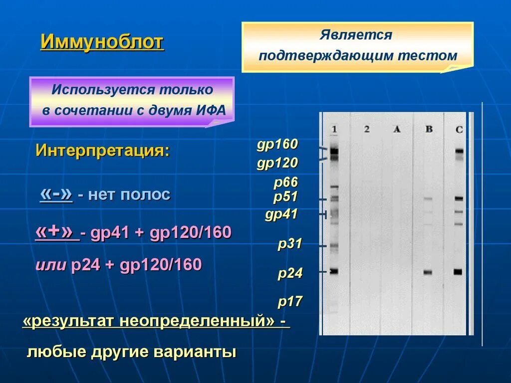 Иммуноблот ВИЧ результат. Иммуноблоттинг для диагностики ВИЧ инфекции. Иммуноблоттинг интерпретация результатов. -Иммуноблот (иммунный блоттинг)..