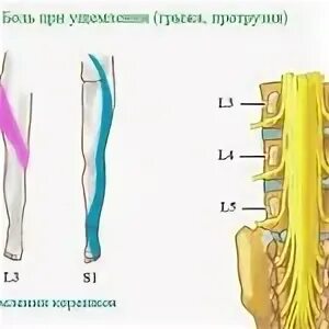 Поясничный отдел l4 l5