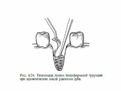 Через сколько убирать