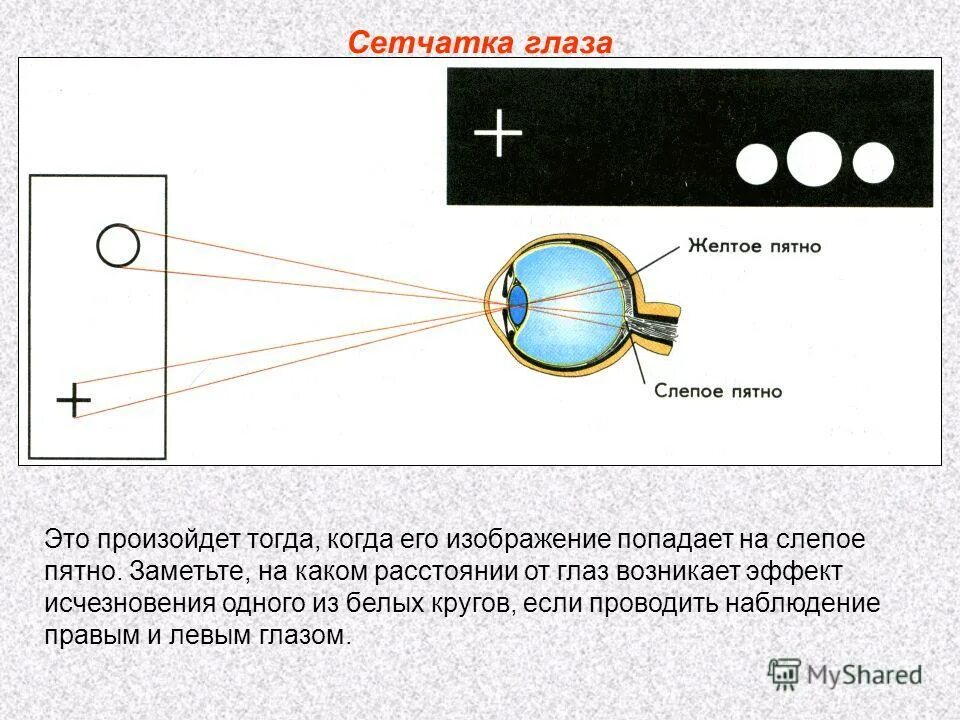 Изображение на сетчатке глаза появляется. Слепое пятно сетчатки. Механизмы компенсации слепого пятна. Опыт обнаружение слепого пятна. Обнаружение слепого пятна сетчатки глаза.