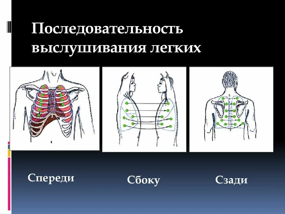 Точка спереди. Сравнительная аускультация легких спереди. Аускультация легких точки выслушивания с боку.