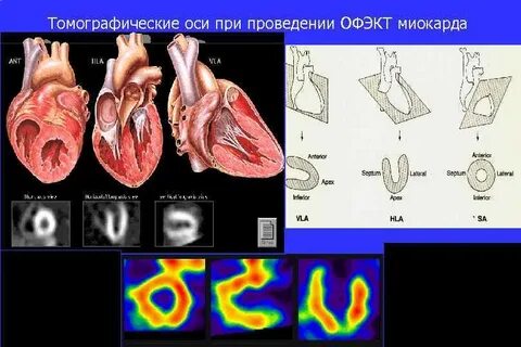 Обследование миокарда
