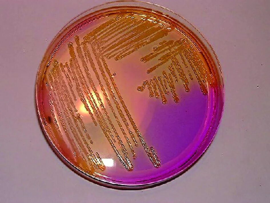 Энтеробактер на Эндо. Enterobacter aerogenes Эндо. Энтеробактерии на среде Эндо. Среда Эндо микробиология. Enterobacter cloacae что это