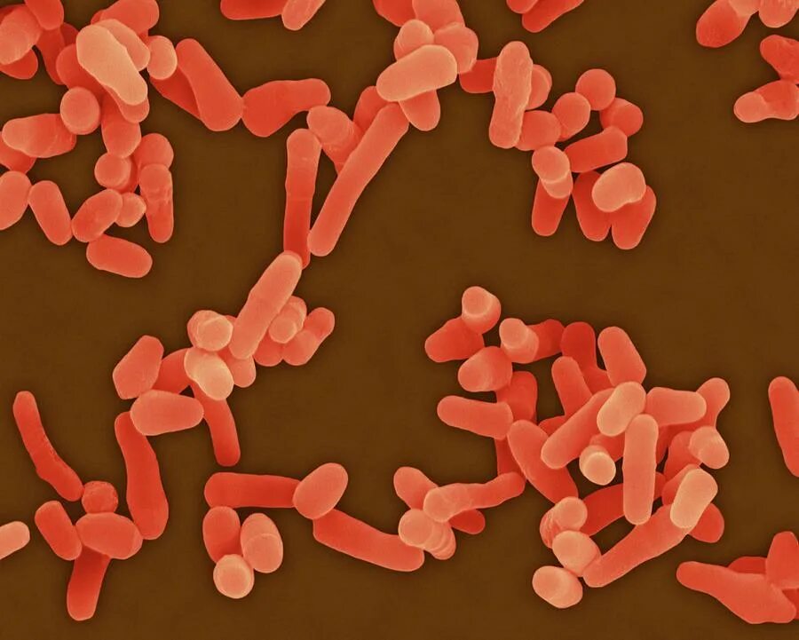 Mycobacterium tuberculosis complex. Микобактериум авиум. паратуберкулез возбудитель. - mycobacterium tuberculosis bovis (бычий).