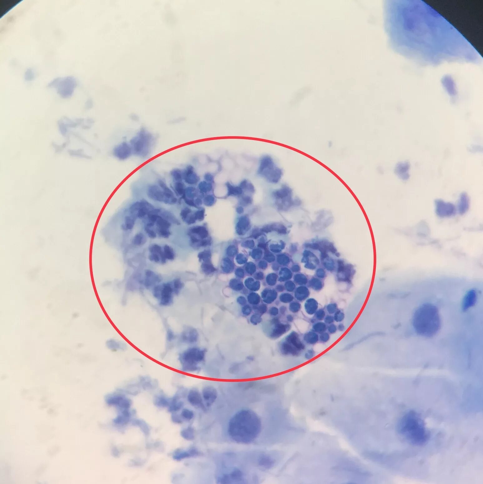 Грибы кандида микроскопия. Псевдомицелий кандида. Мазок кандида микроскопия. Candida albicans мазок микроскопия.