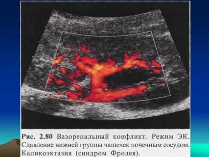 Узи почек магнитогорск