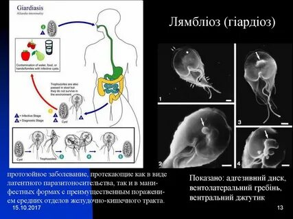 Лямблиоз 2023