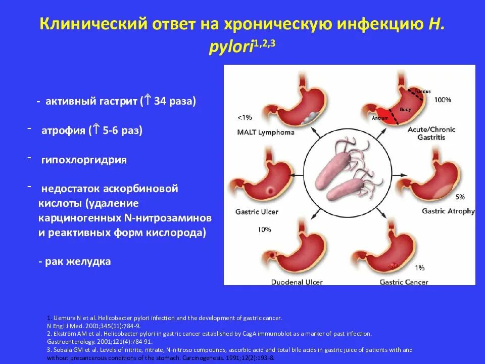 Как восстановить слизистую при гастрите