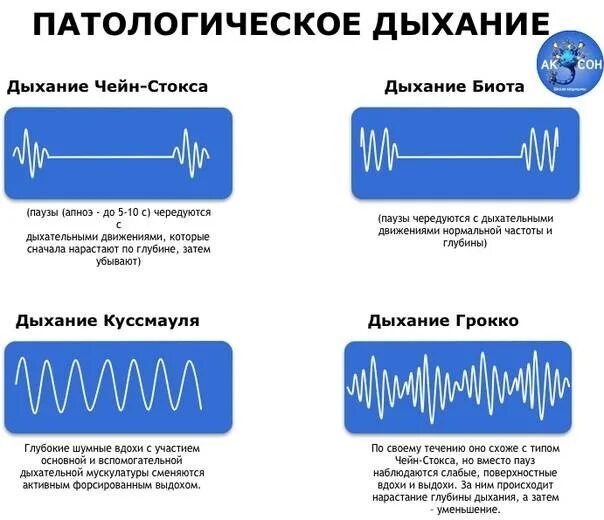 Дыхание 2 д. Дыхание биота чейна стокса куссмауля. типы дыхания биота чейн стокса патологические куссмауля. дыхание типа чейна-стокса. дыхание куссмауля дыхание чейна-стокса дыхание биота.