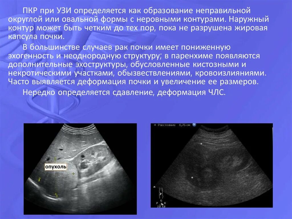 Неоднородное округлое образование