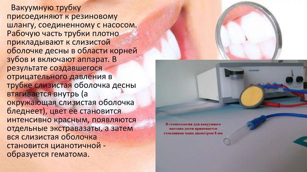 Плотный приложить