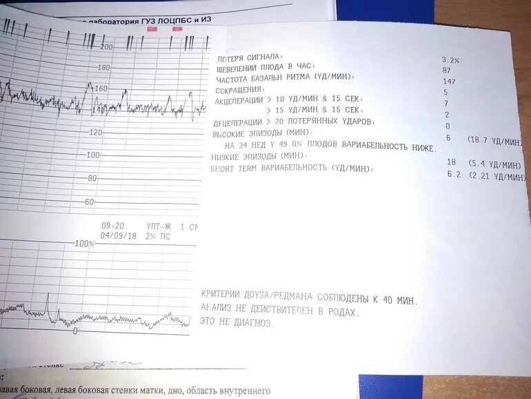 Эпизоды высокой вариабельности на КТГ норма. Низкие эпизоды на КТГ. Низкая вариабельность КТГ. Вариабельность 6.4 на КТГ. Нормы шевелений по неделям