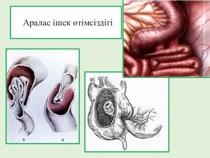 Бүркіт құйрықтары Леся Засветы