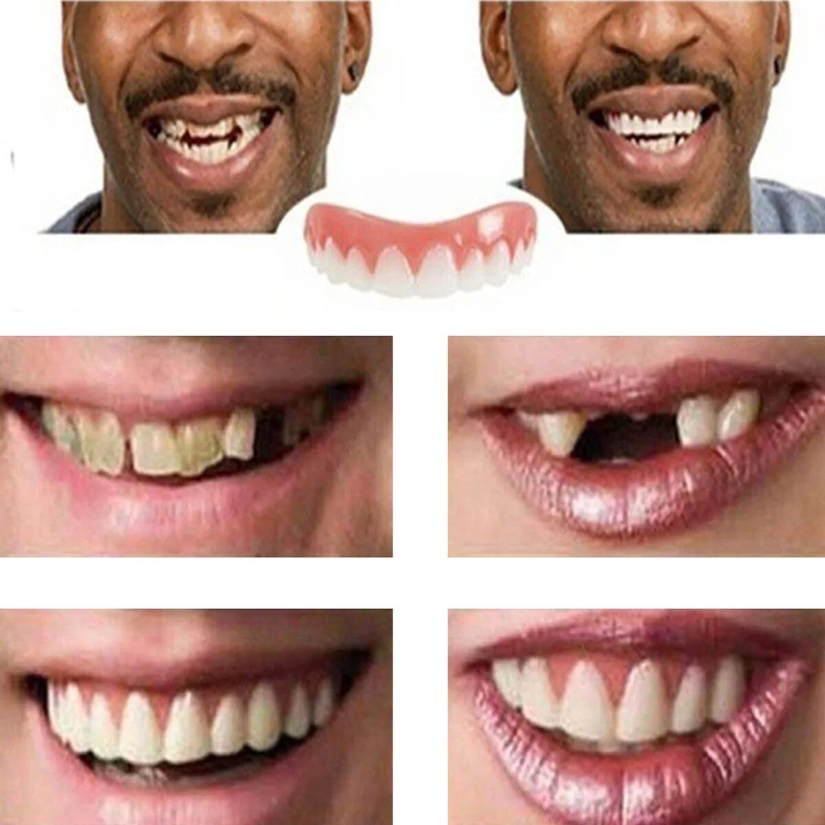 Вставные челюсти виниры. Виниры-элайнеры snap-on smile. Накладки для зубов. Aliexpress зубные виниры. Винилы зубы хорошего качества.