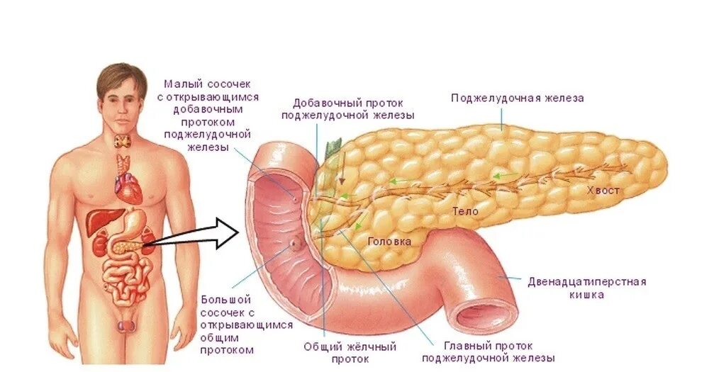 Поджелудочная желелеза. Признаки проблем с поджелудочной. Панкреатит поджелудочной железы. Заболевание желудка панкреатит. Панкреатит поджелудочной железы.