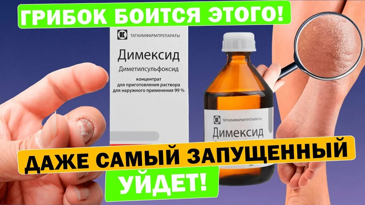 Как лечить ногти димексидом