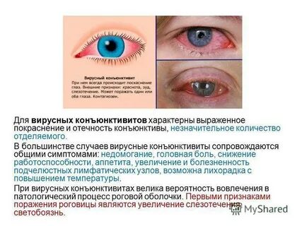 Поразить заметить