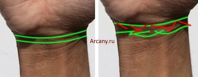 Браслеты на запястье хиромантия. Что означают браслеты на запястье хиромантия. Вторая продольная линия запястья. Хиромантия значение браслетов