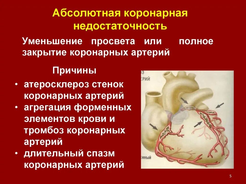 Острая сердечная коронарная недостаточность. Коронарная недостаточность механизм развития. Абсолютная и Относительная коронарная недостаточность. Причины абсолютной коронарной недостаточности. Относительная коронарная недостаточность причины.