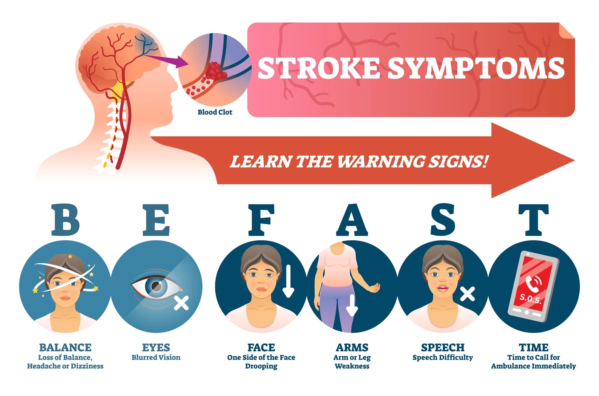 Инсульт вопросы ответы. Инсульт. Stroke Symptoms. Инсульт картинки. Тест на инсульт.