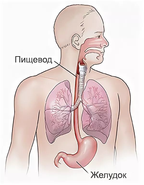 Пищевода 4 стадия. Онкология пищевода , сильный кашель. Что это означает.