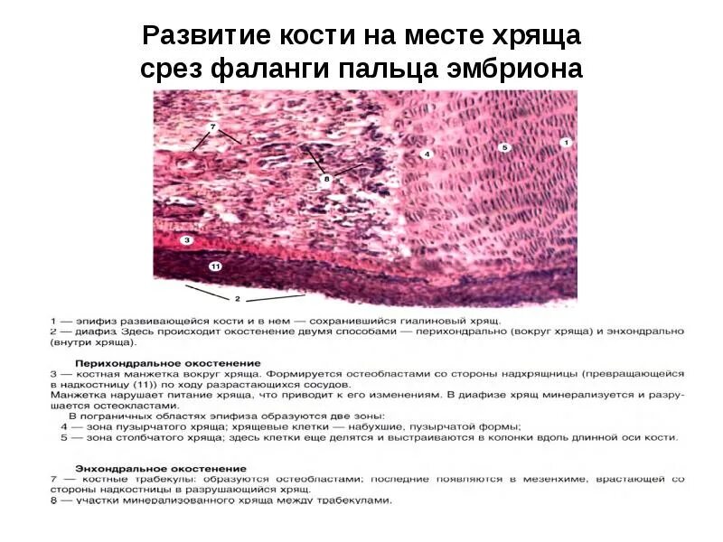 Развитие хряща гистология. Развитие кости на месте хряща непрямой остеогенез. развитие кости на месте гиалинового хряща препарат. развитие кости из хрящевой ткань гистология. трубчатая кость зародыша свиньи препарат.